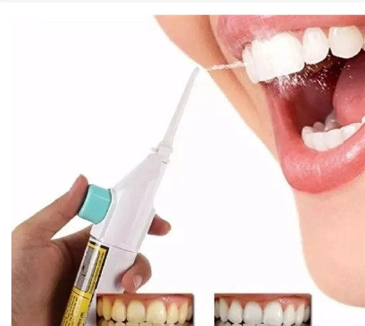 Flash - Jato de água para higienizar dentes